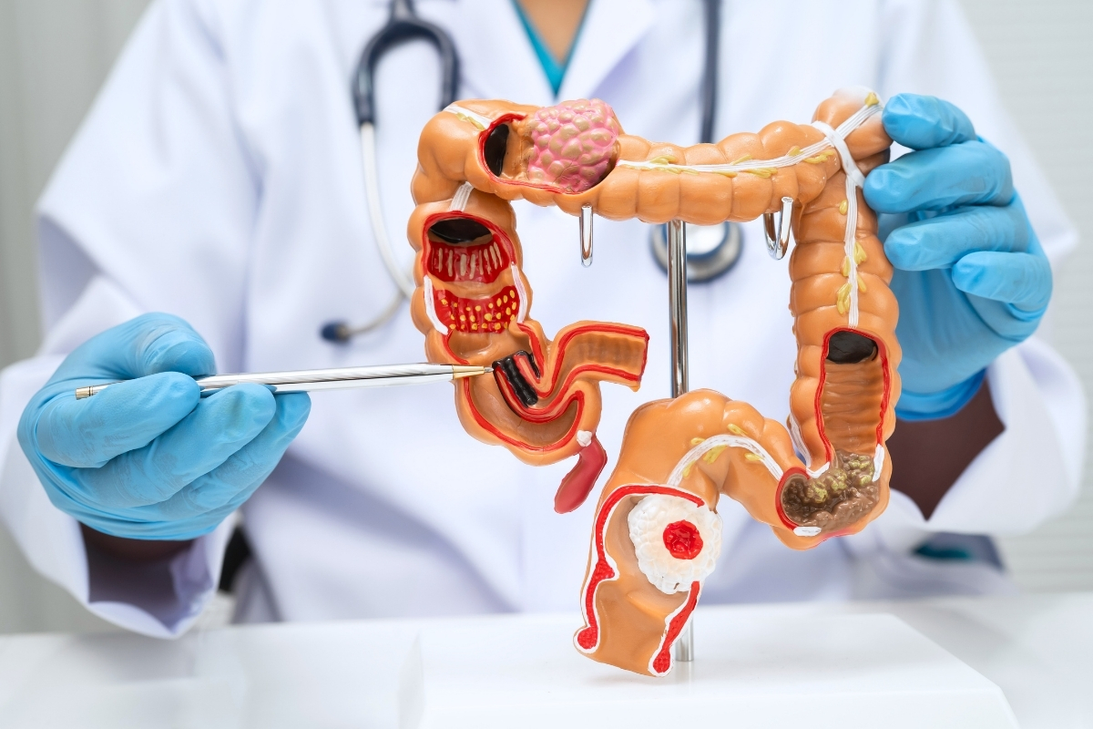 Colon Cancer Screening near me
