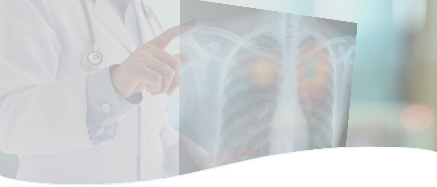 Lung Cancer Screening Orange County